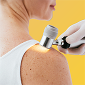 MEDISUR _ Atelier de dépistage des cancers cutanés Atelier Zoom sur ma peau